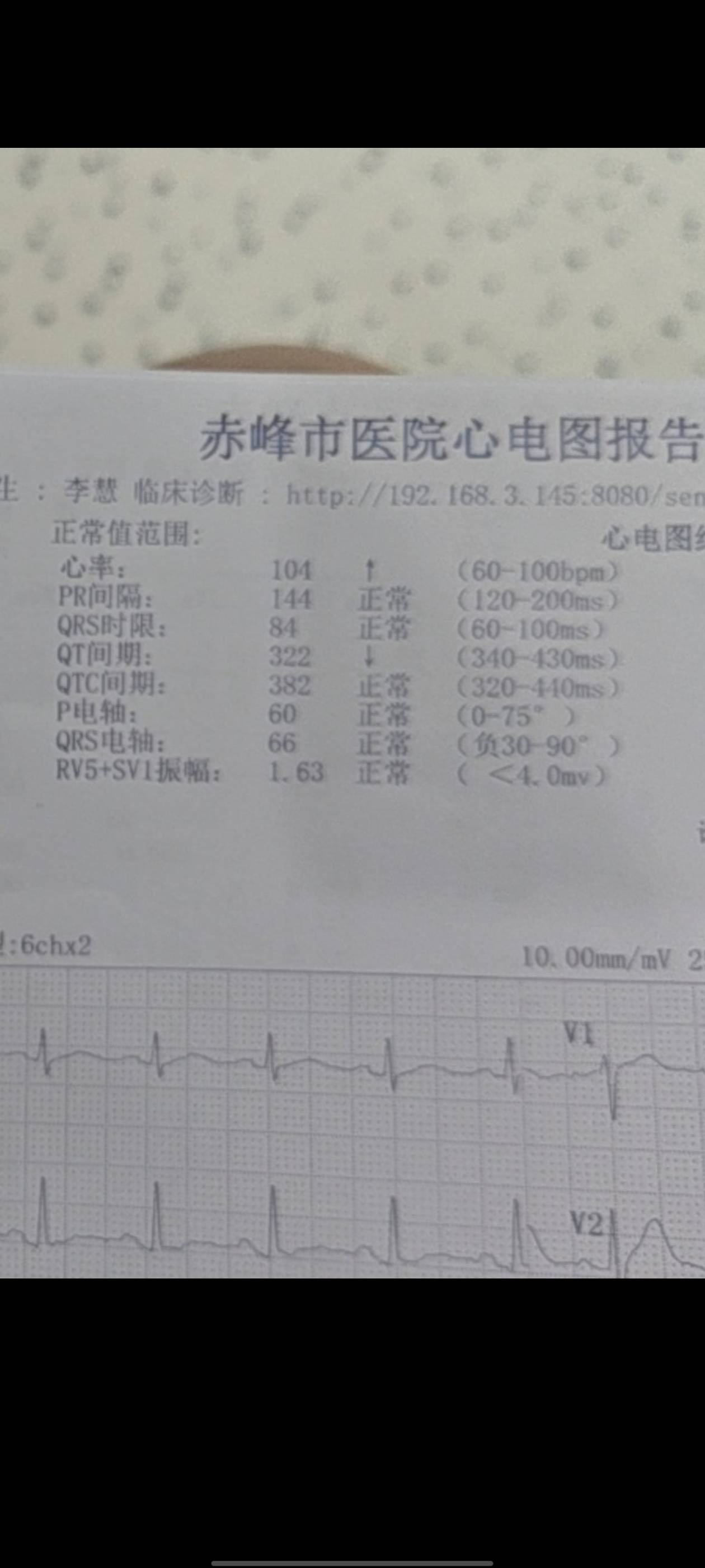 再也不熬夜抢毛了，长期黑白颠倒给我干的心率不齐，憋气，去医院检查一下800毛没了

75 / 作者:逆夏听雨 / 
