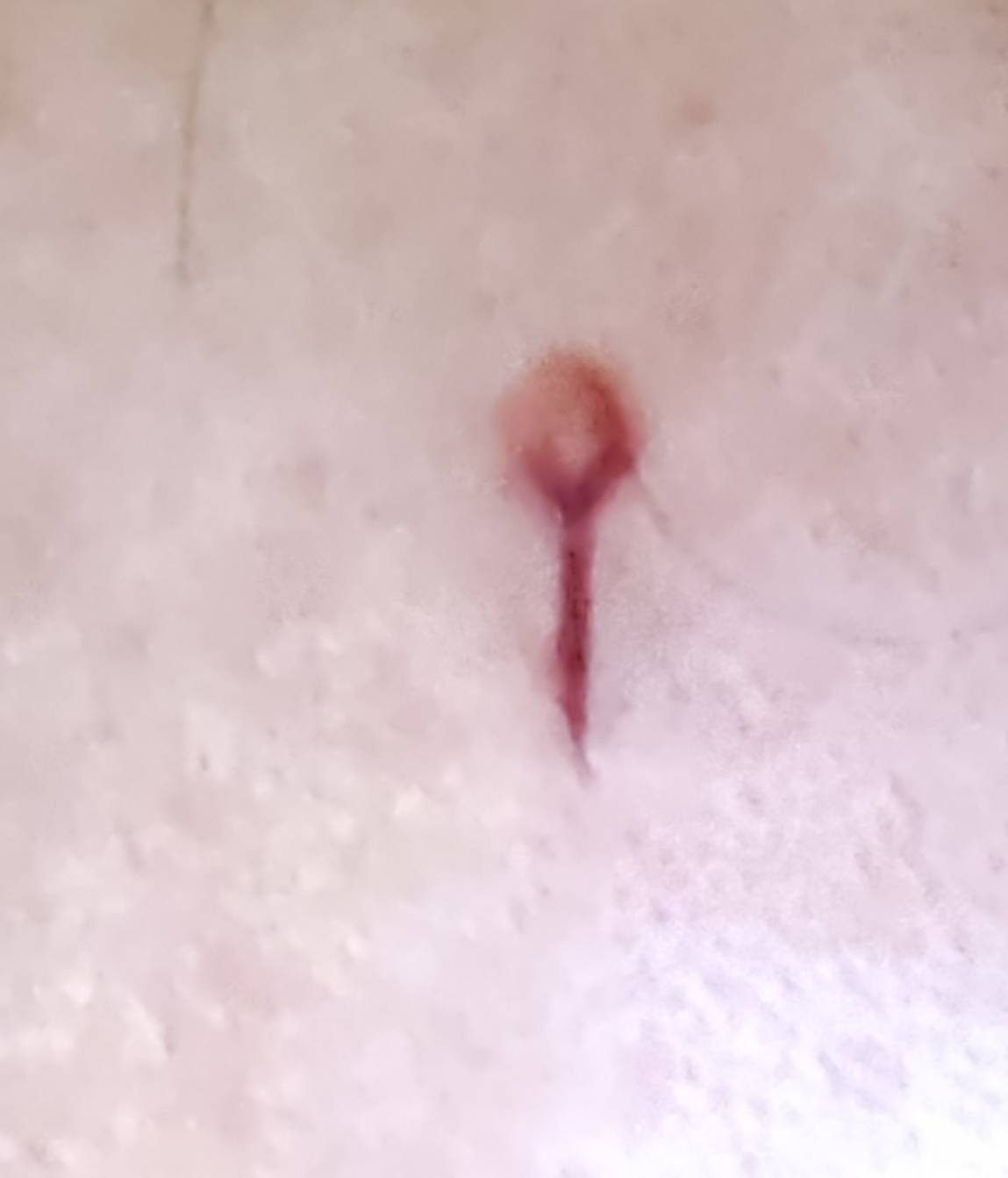 头撞门上了 痛的我怀疑人生
要不要去医院啊 老哥们 能自愈吗

19 / 作者:申请毛真好玩 / 