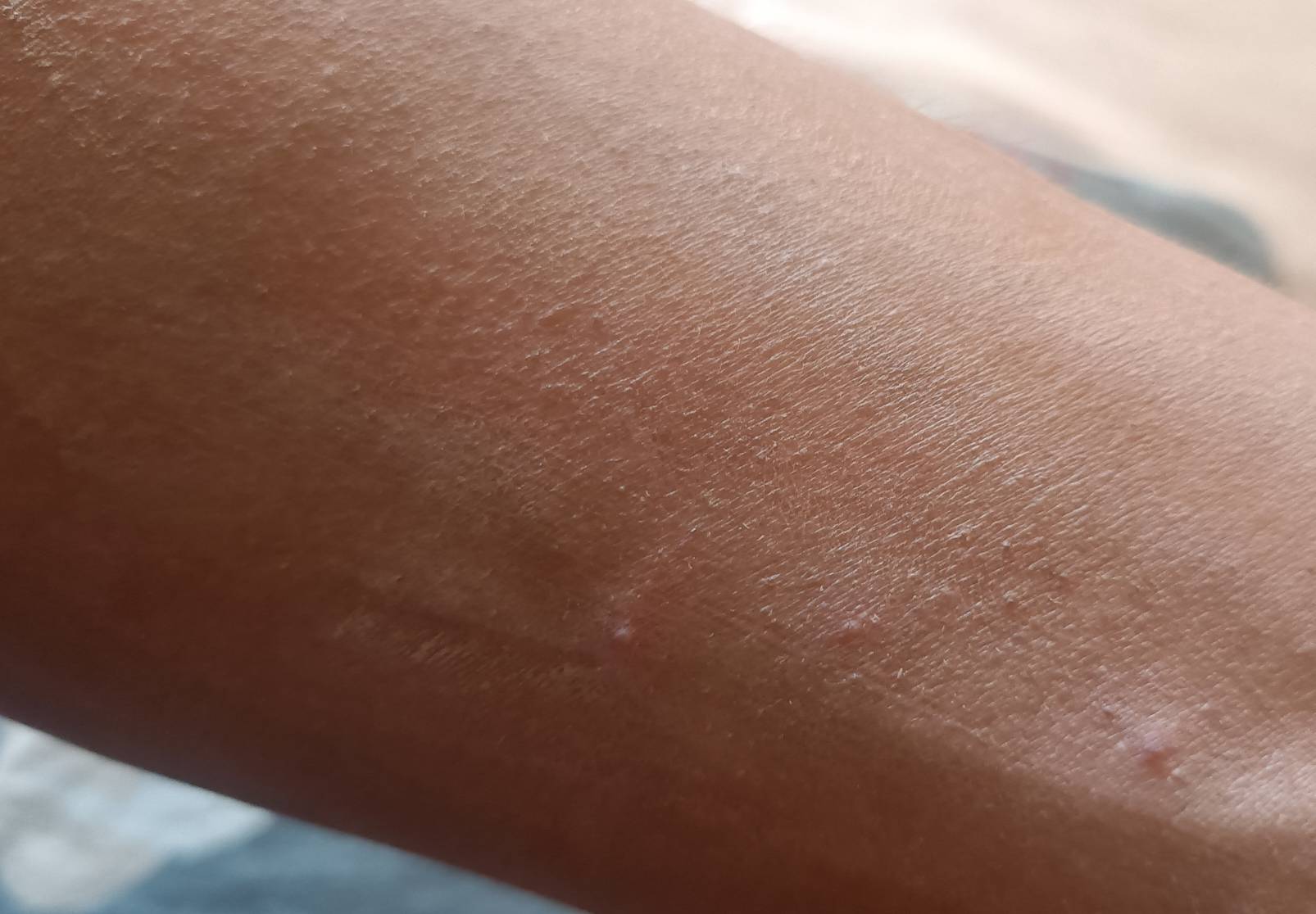 昨天的日结工资发了，真不容易，车间热的跟蒸炉是的，起了一身痱子



81 / 作者:生蚝熟了 / 
