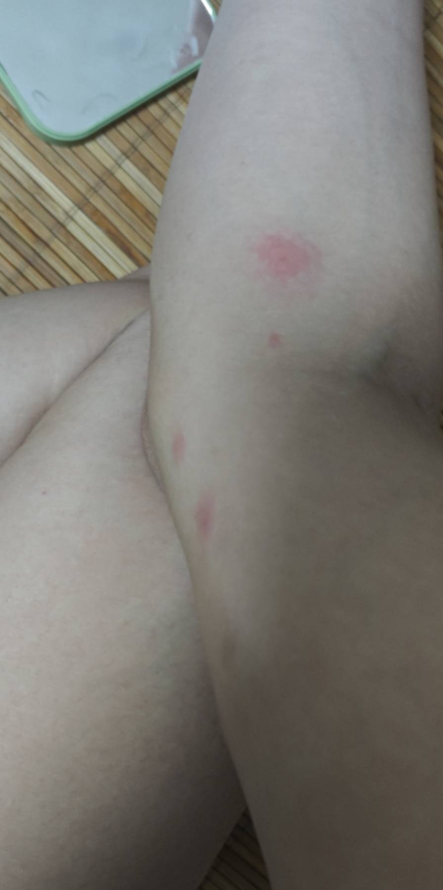有内鬼，终止睡觉，有东西咬我胳膊好庠好庠，估计是小蟑螂仔咬我

92 / 作者:撸毛小王子 / 