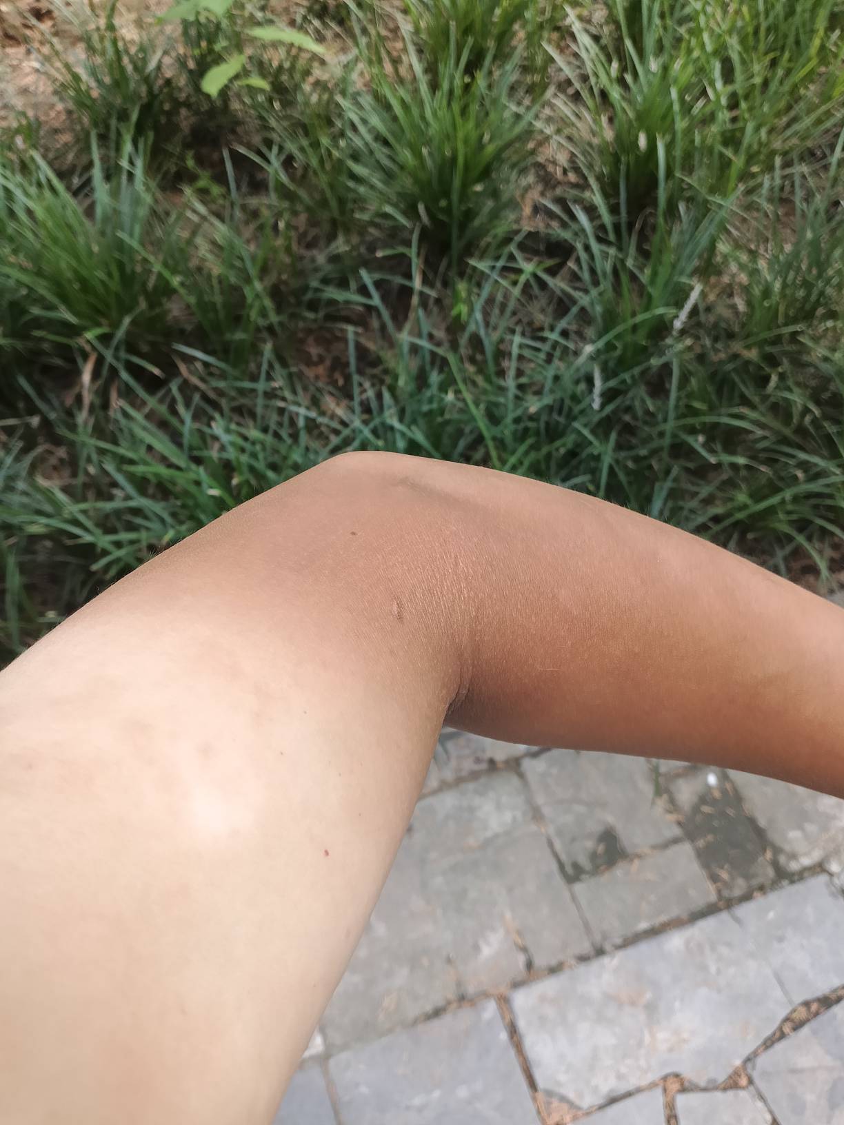 老哥们，夏天你们都被晒黑了嘛？

74 / 作者:你等等我好不好 / 