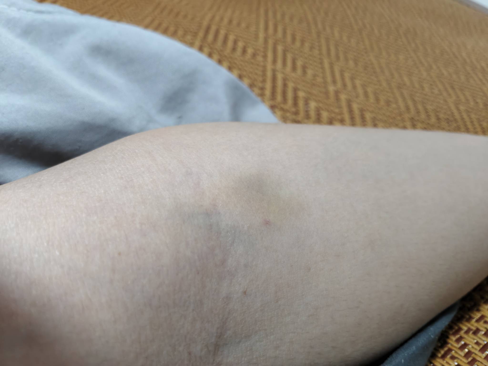 小艺哥，你留！我看到了你的悲惨经历深感痛心，今天我刚卖血卖了500，给你转100！

78 / 作者:汉升 / 