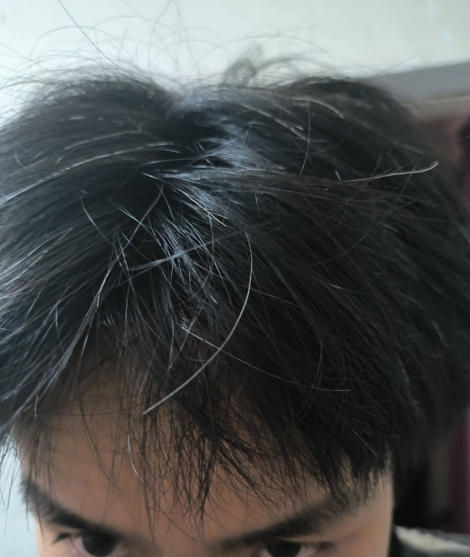 老哥们我才二十六七岁这白头发是越来越多了

42 / 作者:小萘酱 / 