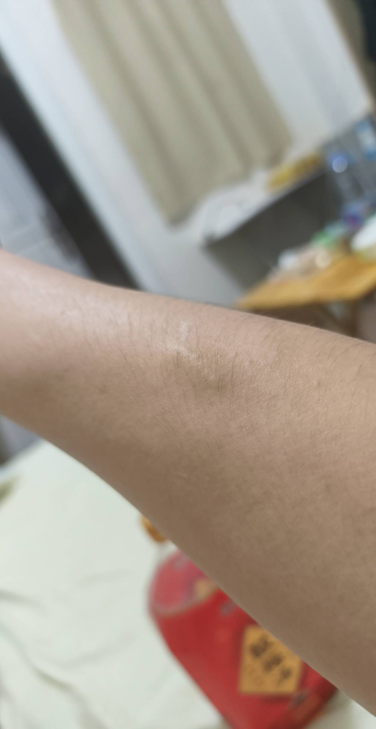 老哥们出事了，我这胳膊里面的筋怎么无缘无故翘起来了。没有碰到什么的

79 / 作者:挂比了救我鸭 / 