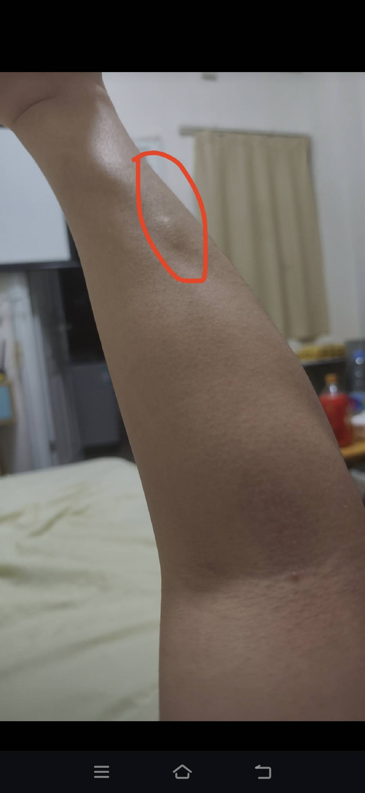 老哥正常吗，一个多月了救我


29 / 作者:挂比了救我鸭 / 