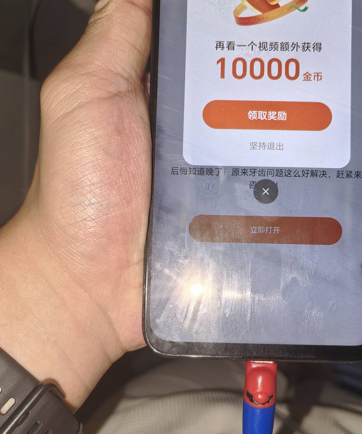 美团标也可以试试这种团购的，牙齿的，可以买，这种团购的后续可以退


26 / 作者:从简从简 / 