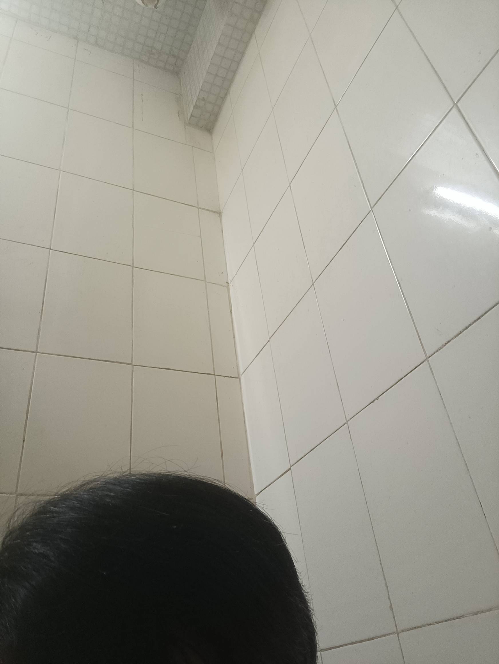 有m秃老哥吗，我31发际后移成这样了，又没钱植发-哎！

0 / 作者:东方神鹰 / 