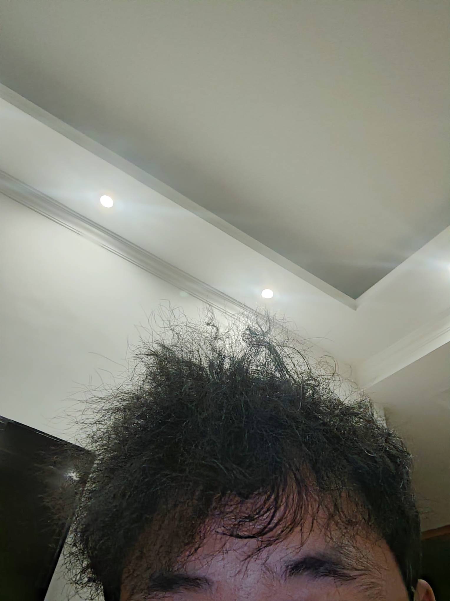 有m秃老哥吗，我31发际后移成这样了，又没钱植发-哎！

73 / 作者:烟火里的尘埃11 / 
