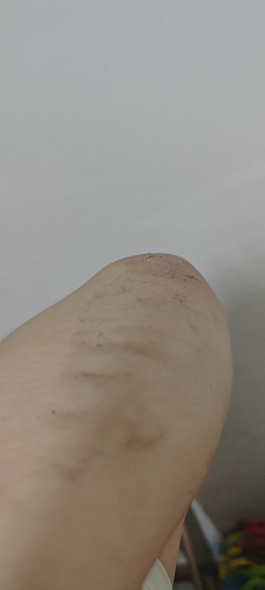 好想申请房东啊，楼梯滑下去命都差点摔没了，手机摔扁两个角，顶层上不关门下雨导致楼94 / 作者:撸毛小王子 / 