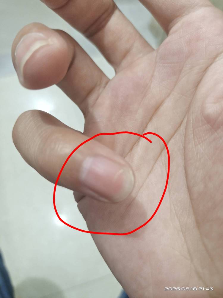 刚才，切菜不小心切到手了，多久能痊愈


35 / 作者:挂壁哥 / 