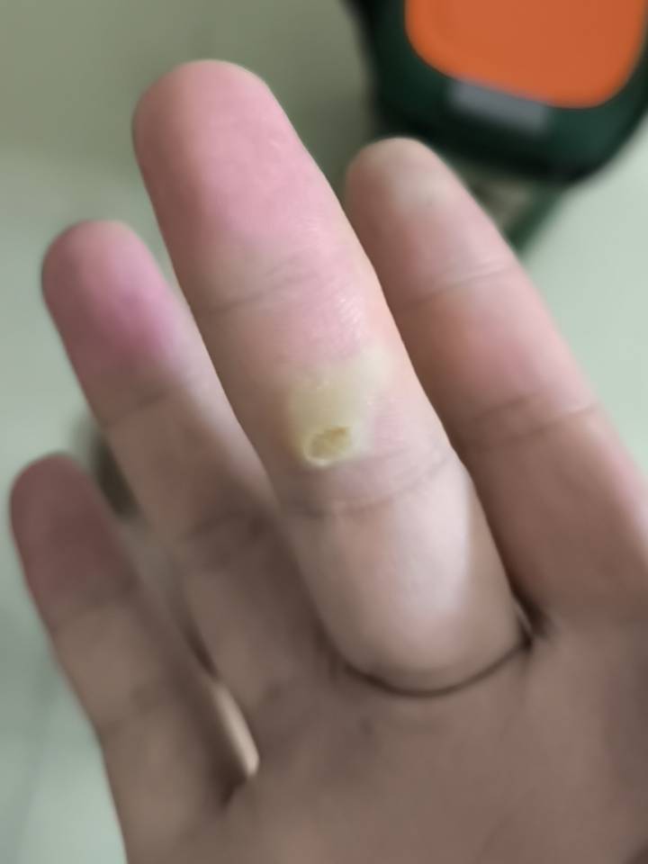 这个是什么吖破了怪怪的。老不恢复

59 / 作者:知了好不 / 