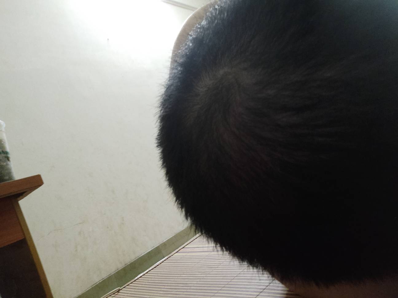 30岁就秃成这样了，玛德不敢打斐济了


61 / 作者:云边有个挂壁仔 / 