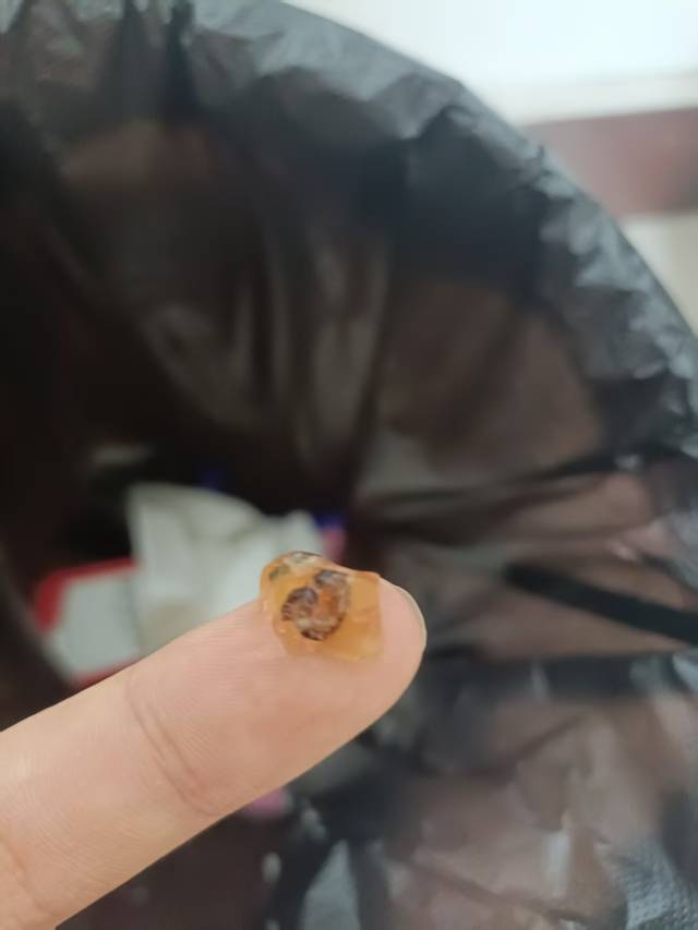 老哥们甜啦啦奶茶果肉里有虫子  客服才愿意赔50  怎么办

1 / 作者:豪蝶璐爱 / 