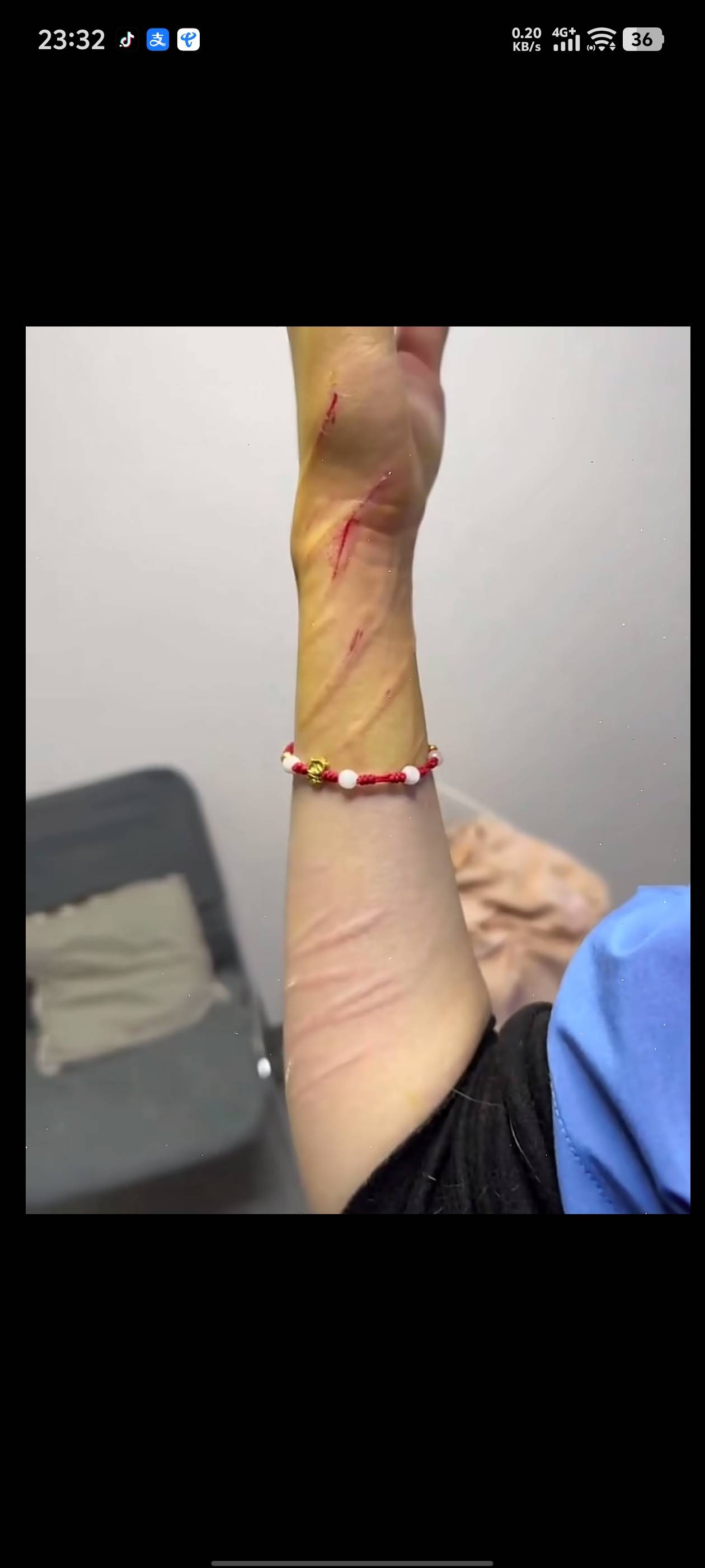 这女的是个人才。竟然给猫剃毛。挠不死你，猫听到这声音都得应激



33 / 作者:晴空免疫性 / 
