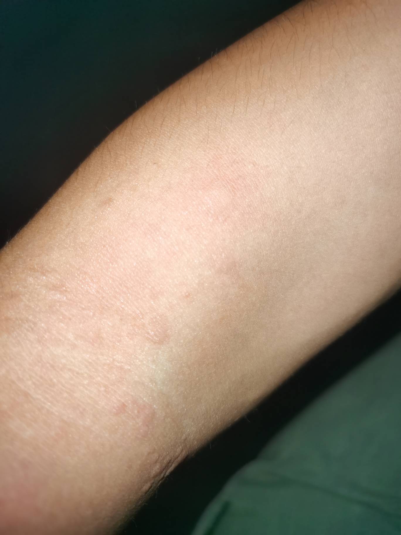 沦落到睡大棚里面也是没谁了，等天亮找个没人的地方把衣服身体洗干净，不然不敢去人流74 / 作者:没监控不管 / 