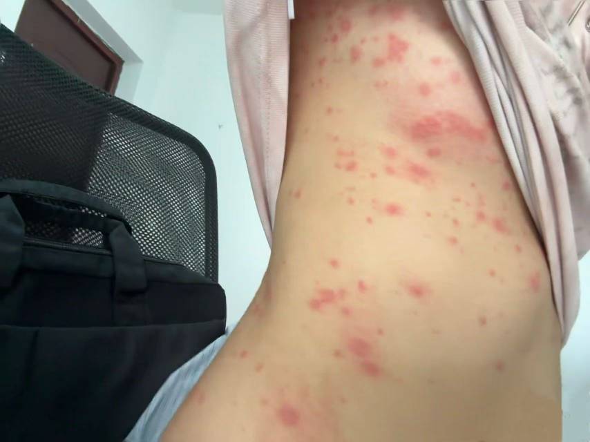 老哥们出事了，帮我看看肚子咋了

20 / 作者:挂比了救我鸭 / 
