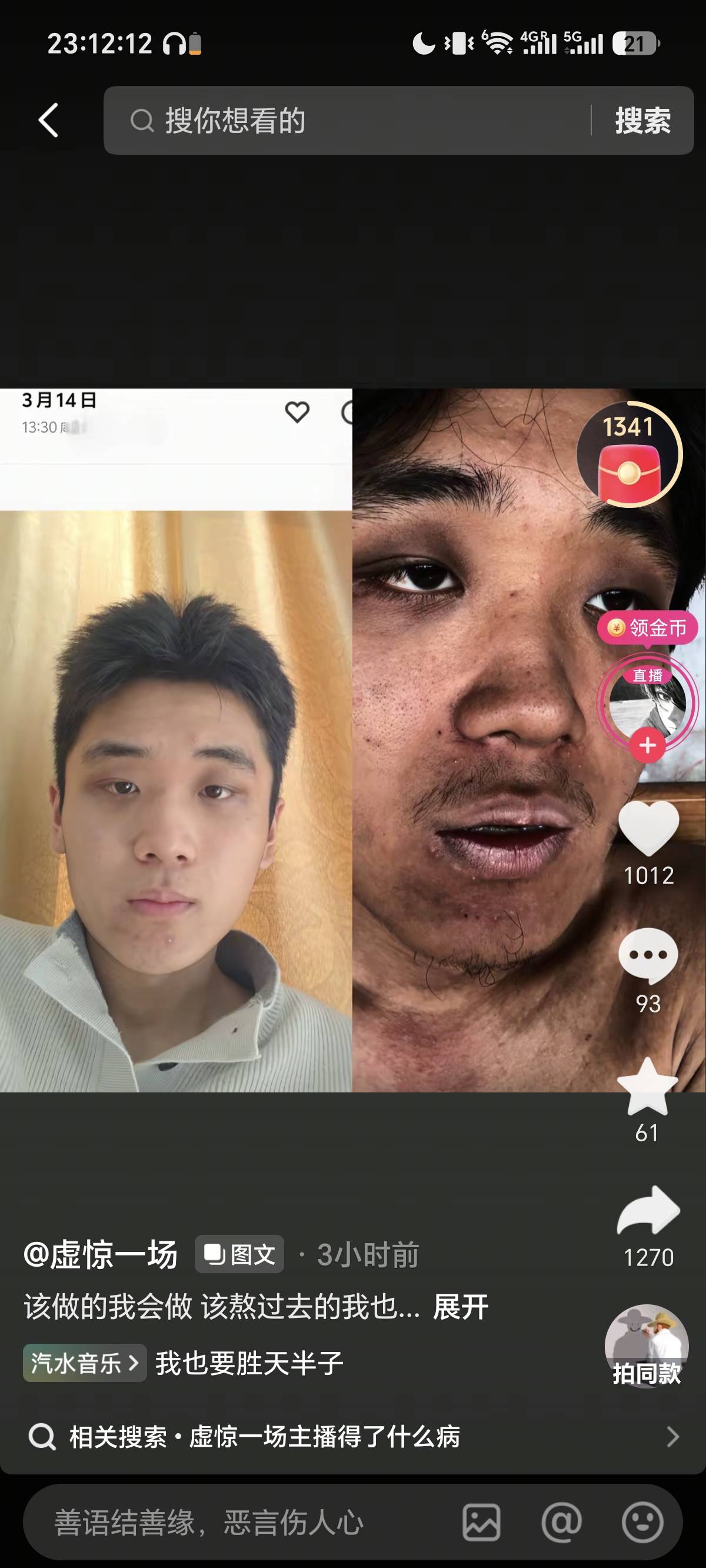 连冲73天就这样了吗老哥们

1 / 作者:挂币仔 / 