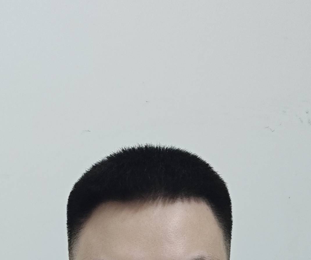 没上班不出门不晒太阳，额头脸上都是反光的

47 / 作者:撸毛小王子 / 