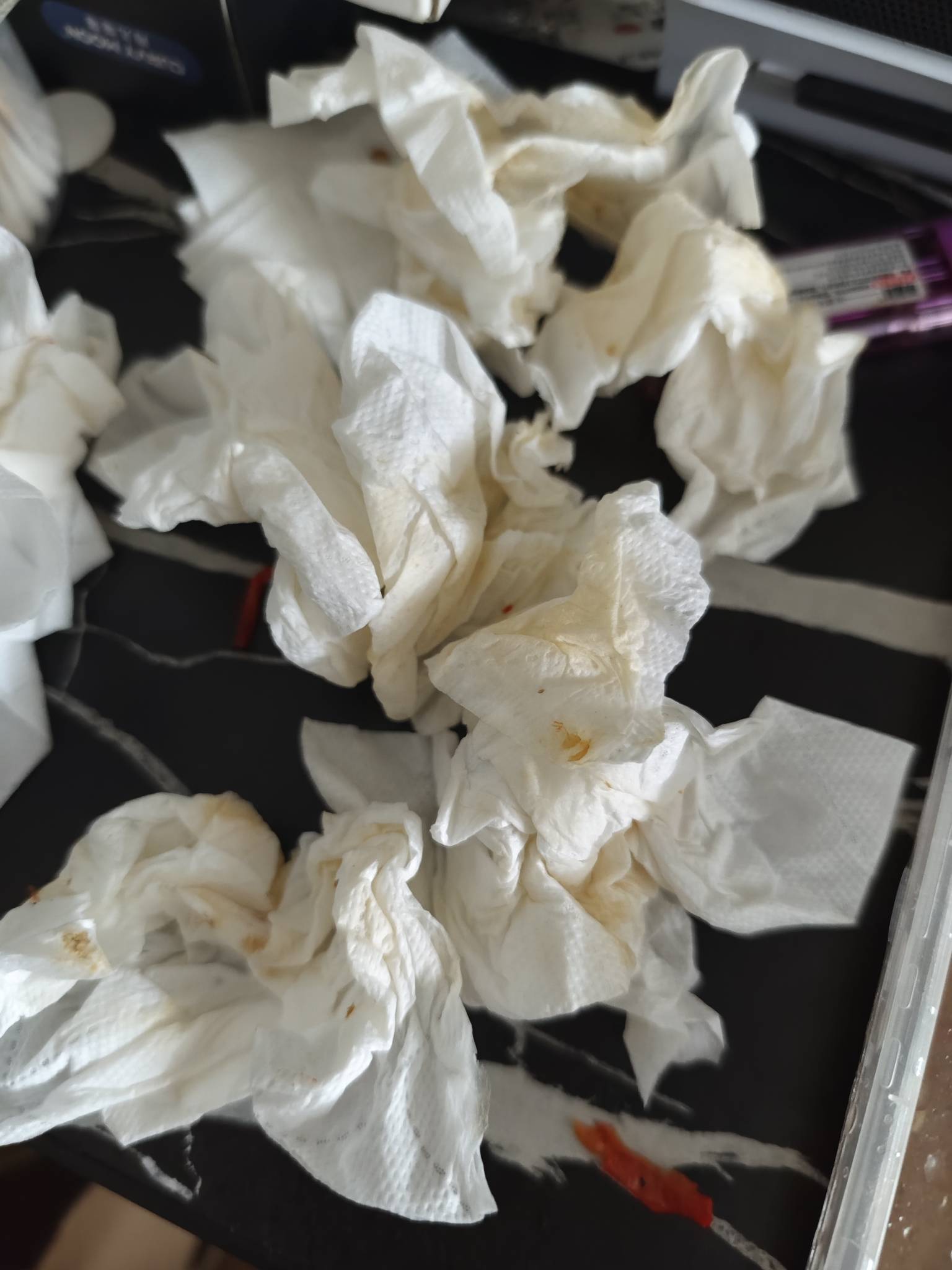 最近可能是有点上火吧，颜色都变成这样了

14 / 作者:先天挂逼圣体 / 