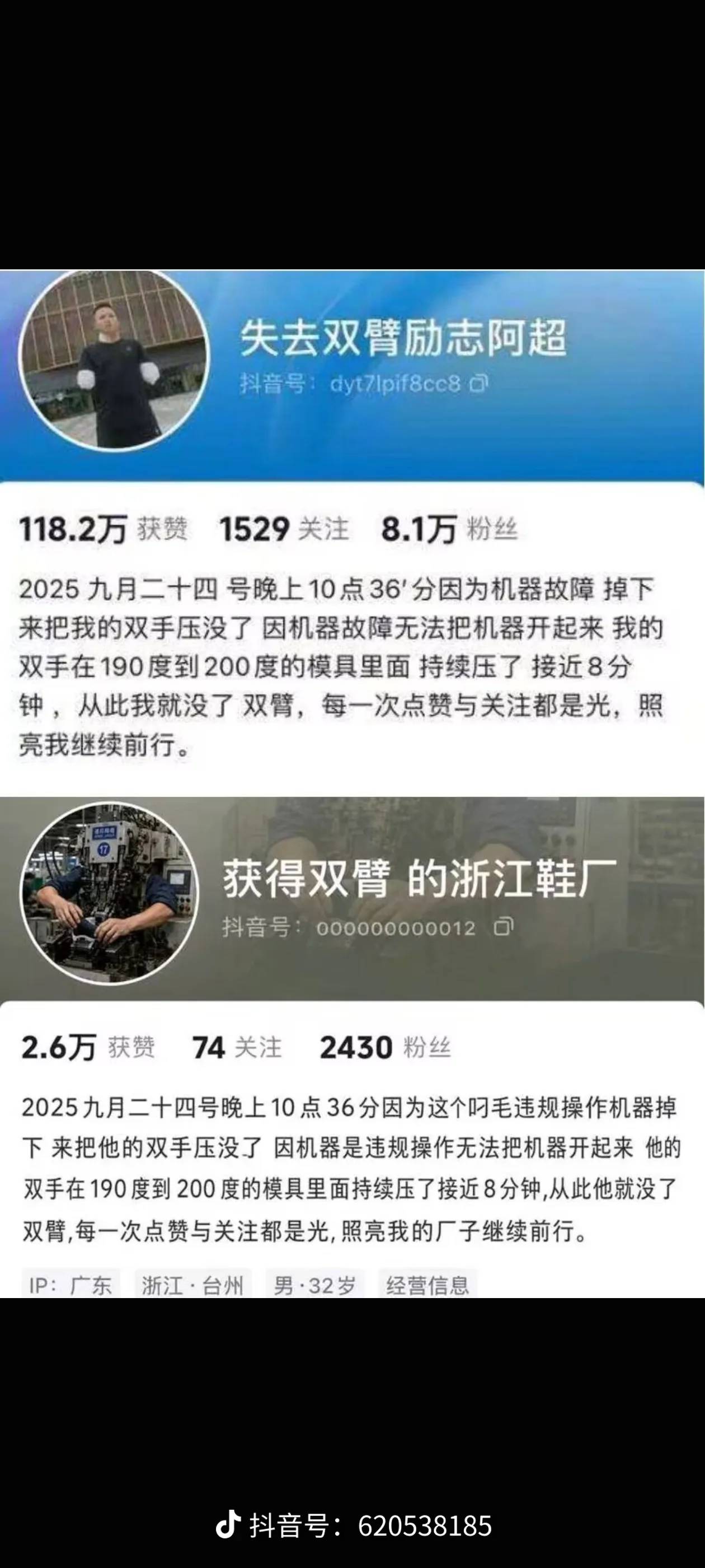 2025 九月二十四号晚上10点36′分因为机器故障掉下来把我的双手压没了 因机器故障无法90 / 作者:姜末摸摸 / 