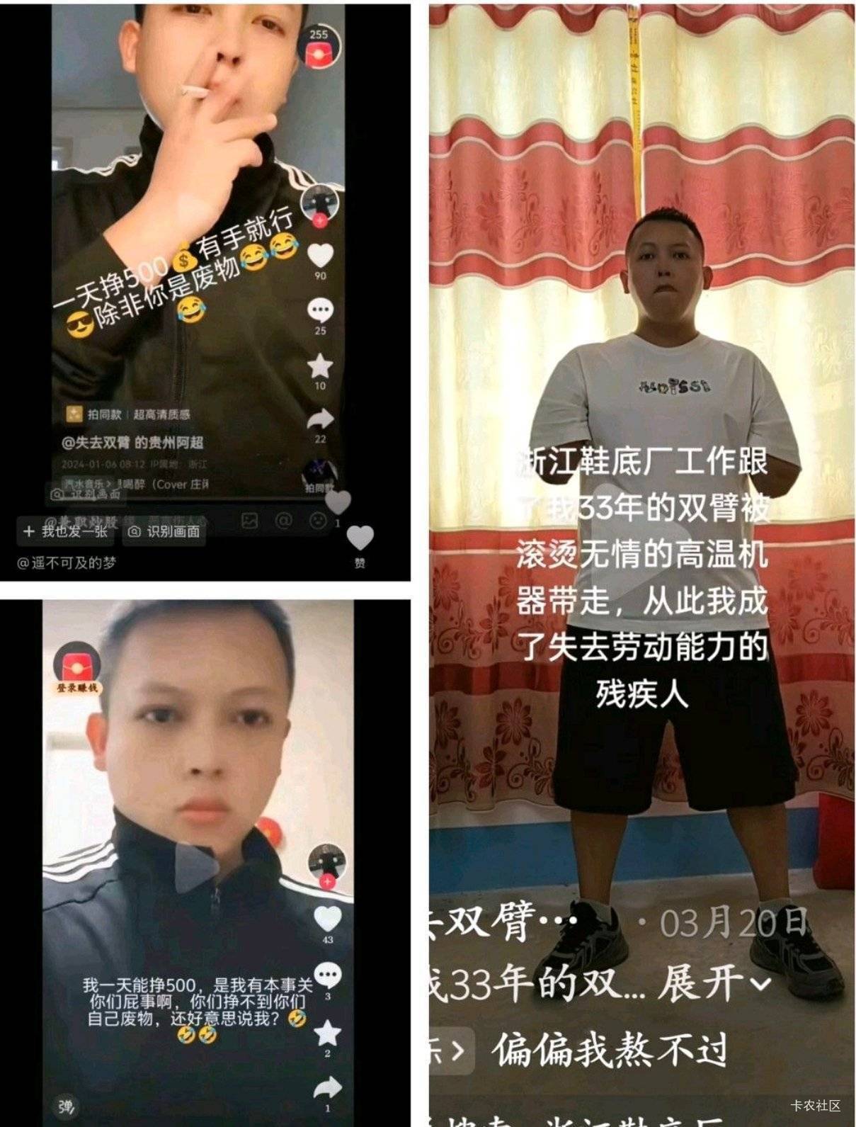 2025 九月二十四号晚上10点36′分因为机器故障掉下来把我的双手压没了 因机器故障无法55 / 作者:姜末摸摸 / 