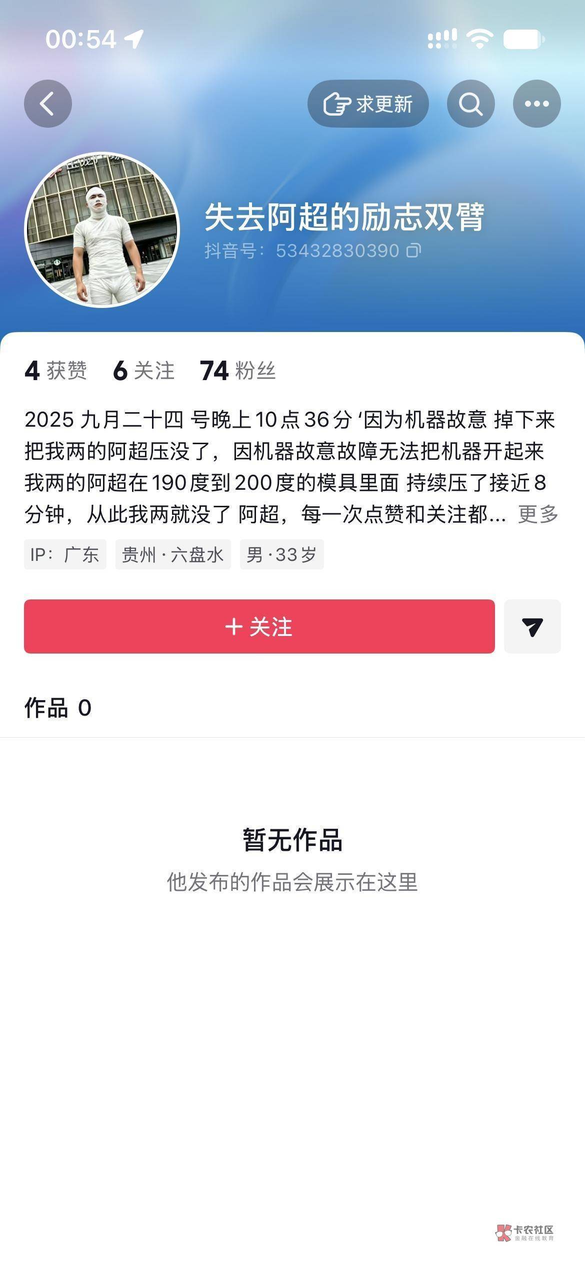 2025 九月二十四号晚上10点36′分因为机器故障掉下来把我的双手压没了 因机器故障无法55 / 作者:0撸狗 / 