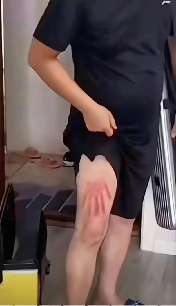 昨晚睡早 刚醒  错过了大毛  大腿拍肿了

53 / 作者:陈小刀99 / 